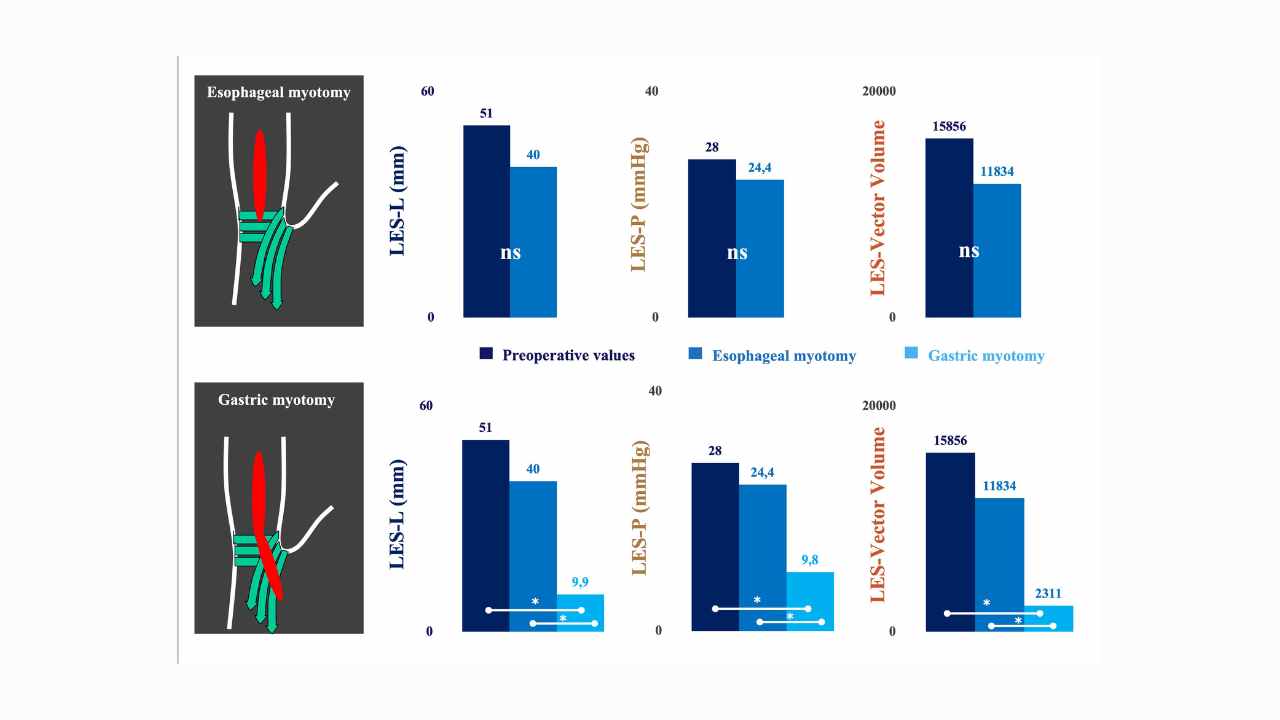 The evolution of surgical treatment for achalasia: from experimental evidence to real-world impact
