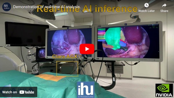 AI assistance in the operating room: a step closer to reality