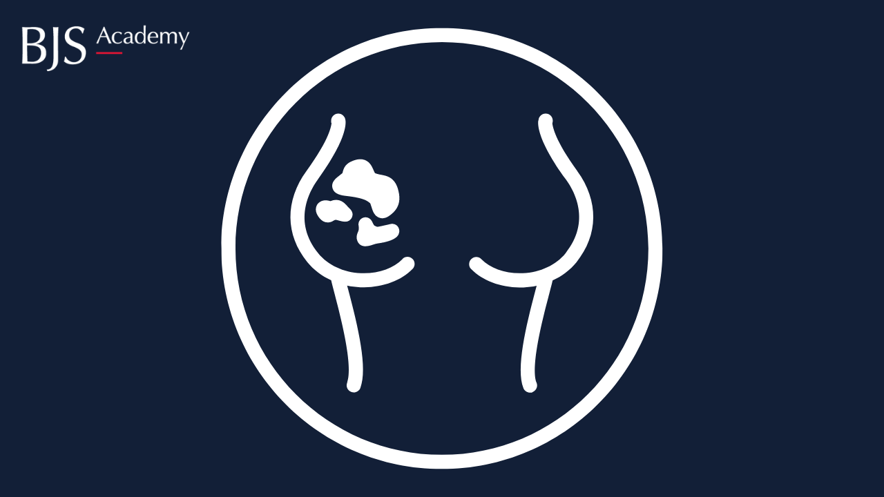 The iBRA-NET Localisation Study: A national prospective cohort study comparing the safety and effectiveness of wire- and magnetic seed-guided localisation for non-palpable breast lesions.