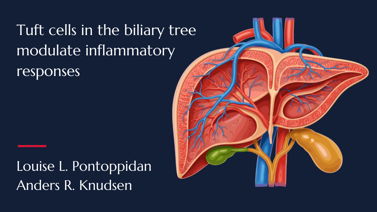 Tuft cells in the biliary tree modulate inflammatory responses