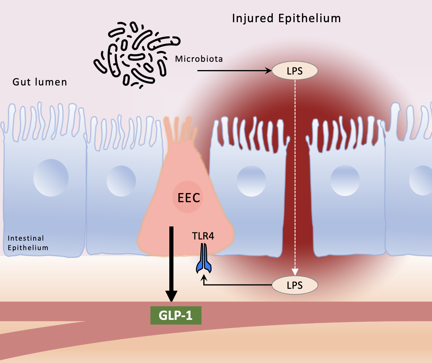 A surprising role for enteroendocrine cells and GLP-1 in regulating intestinal inflammation.